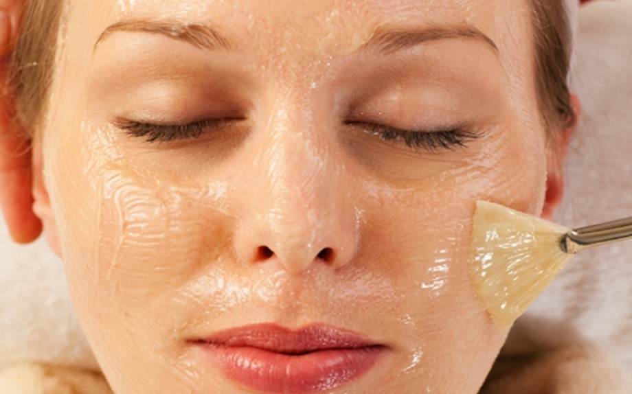 peeling viso acne